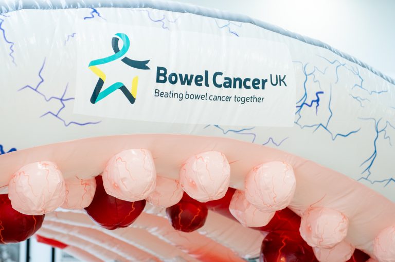 Giant inflatable bowel to raise cancer awareness in Grimsby